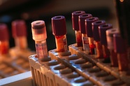 Photo of test tubes containing blood