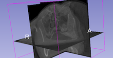 Medical image overlaid with horizontal and vertical planes for delicate measurements image