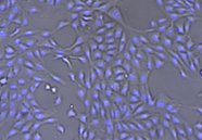 MCF10A cells 186