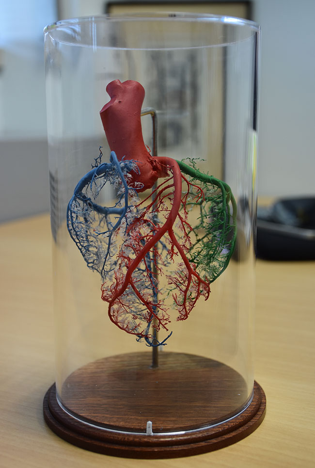 Model of Heart (from Christchurch Heart Institute in 2017)