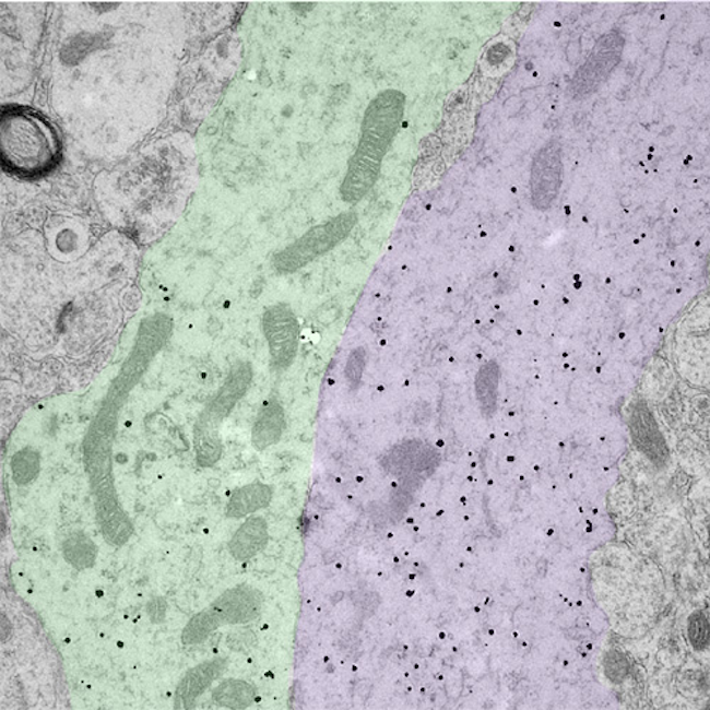 TEM bundled neuron dendrites image