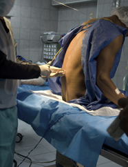 A patient receiving an epidural