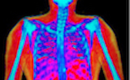 DXA scan image of a human torso thumb