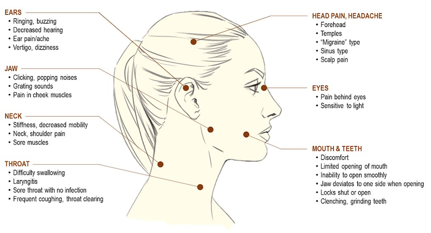 Drawing of woman's head in profile with symptoms of Temporomandibular disorders listed for seven sites on the head and neck