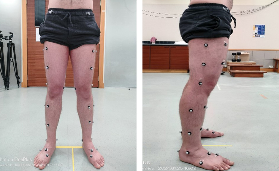 Front and side views of a man's legs in shorts, with many small reflective markers stuck to the legs and feet.