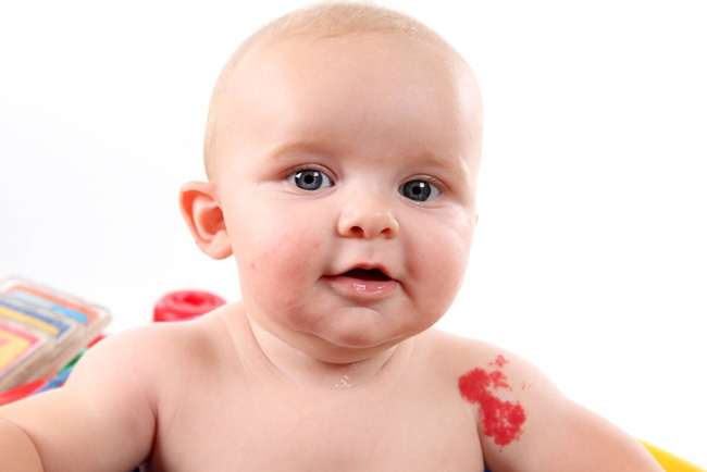 birthmark-image