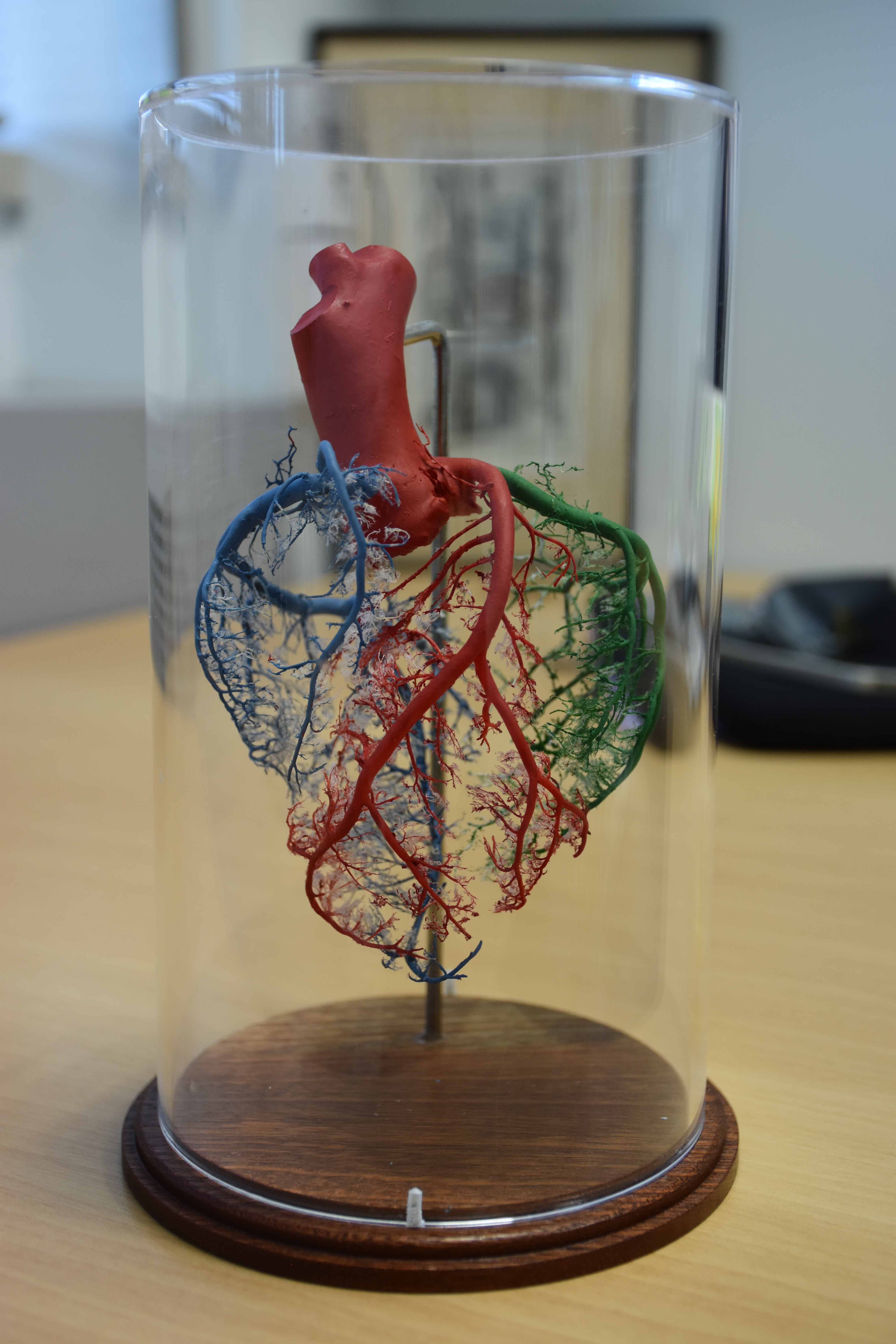 Model of Heart CHI 2017 (2)