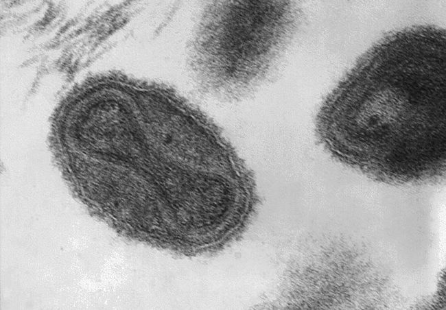 Electron micrograph of smallpox virus particles.