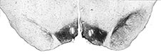 Scan showing dopamine cells depleted in the left half of the brain in a rat with gut dysfunction and Parkinson's disease image