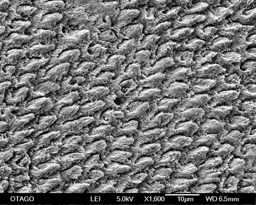SEM teeth_500pxwide