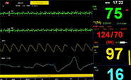 ICU monitor screen image thumb