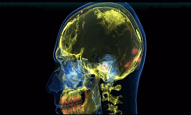 Neurodome-image
