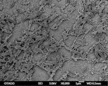 Bacterial Biofilm