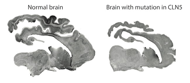Otago Biochemistry What Causes Batten Disease Research Department 