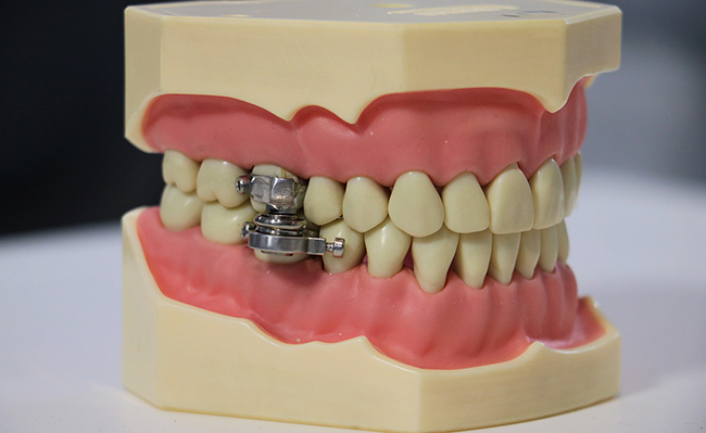 dental implement 4