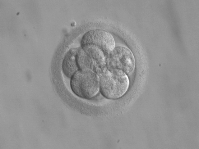 Micrograph of a human embryo at the 8-cell stage of development.
