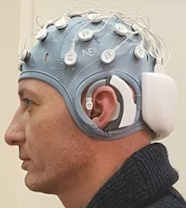 Multichannel Transcranial Electrical Stimulators and EEG_thumbnail