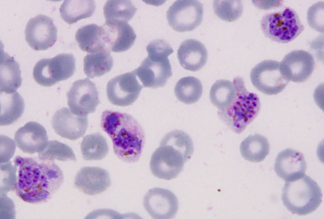 Four human red cells infected with mature vivax malaria parasites image