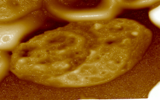 P.vivax binding with the surface of red blood cells 