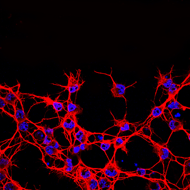 Red and blue confocal microscopy of neurons image by Christine Jasoni