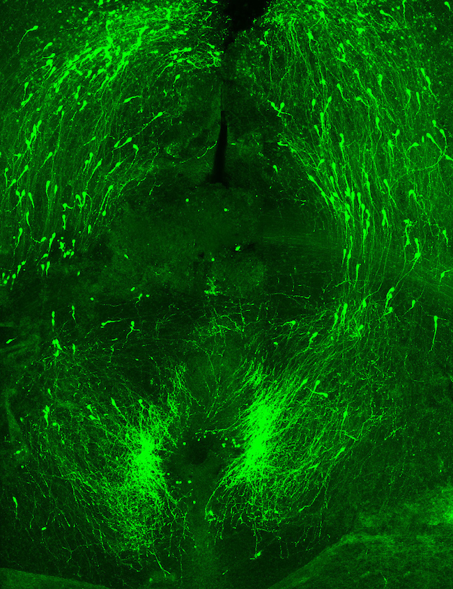Fluorescent green confocal microscopy hippocampus image by Christine Jasoni