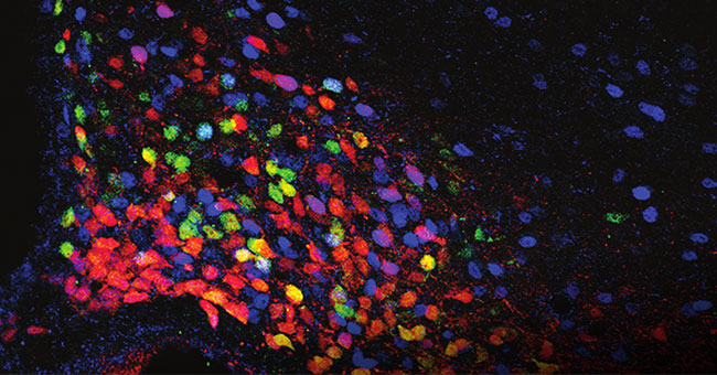 A black background with blobs of blue and pink and yellow on it, is an image of the brain