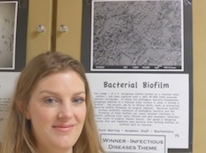 Susie Warring Webster Centre OSMS Photo Competition Winner with Bacterial Biofilm Photo