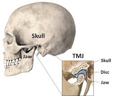 A human skull with an enlargement showing the detail of the joint where the jaw, disc and skull fit together