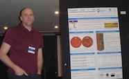 Picture of Dr Ian Monk (Doherty Institute) who was awarded a poster prize at the QMB ID 2017 meeting