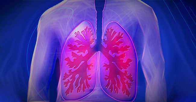 A graphic showing a person's lungs