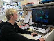Photo of PhD candidate Henry Beetham assessing CDH1 expression in gastric cancer cells