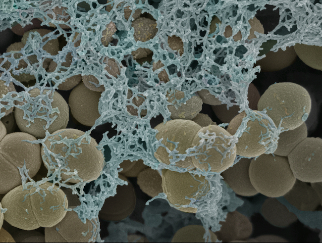 Streptococcus gordonii biofilm image