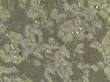 Lipid-rich mature adipocytes