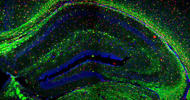 Multi-coloured confocal microscopy hippocampus dual image by Christine Jasoni
