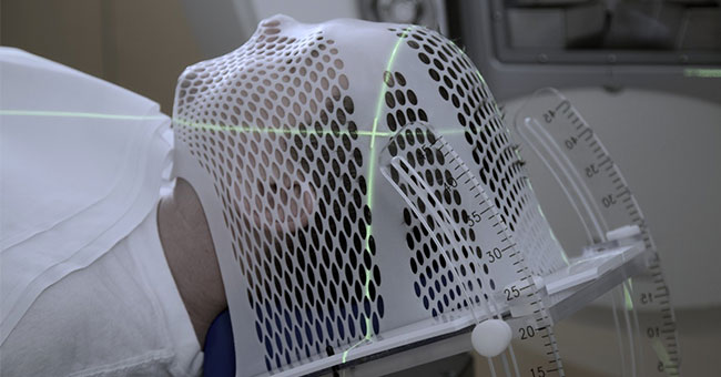 Radiotherapy generic image