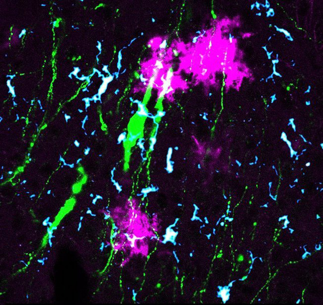 Desroziers_Astro-Microglia-GnRH-filter image