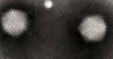 Electron micrograph of adenoviruses.