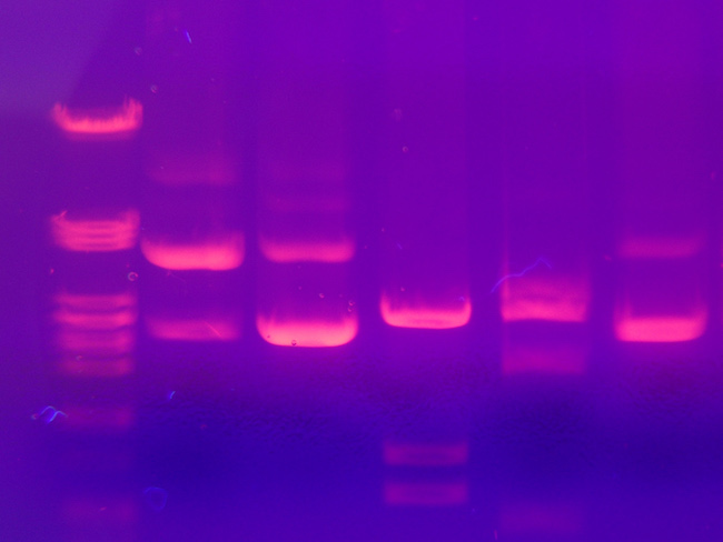Gel in which DNA has been separated using electrophoresis.