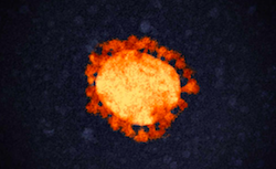 Link to electron micrograph of coronavirus