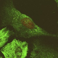 Microscopic image of the stablisation and nuclear localisation of p53(red) to nucleus in a stressed cell