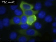 Microscopic image of YB-1 mutation two