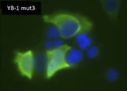 Microscopic image of YB-1 mutation three