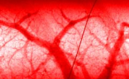 Red blood vessels thumbnail