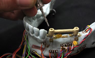 Jaw bone with dental attachments thumbnail