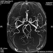 MRI brain image