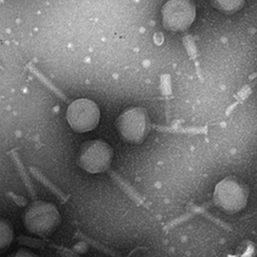 TEM negative staining of bacteriophage image 