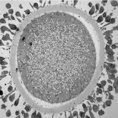 Conventional TEM image of sheep oocyte image