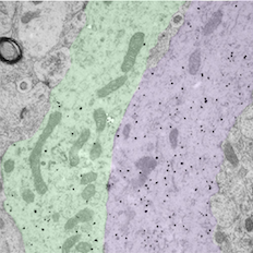 Bundled GnRH neuron dendrites image