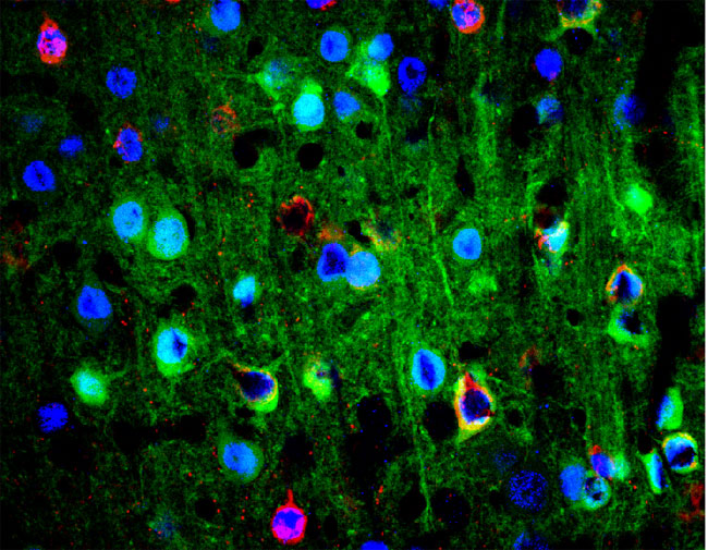 Diverse cortical neurons