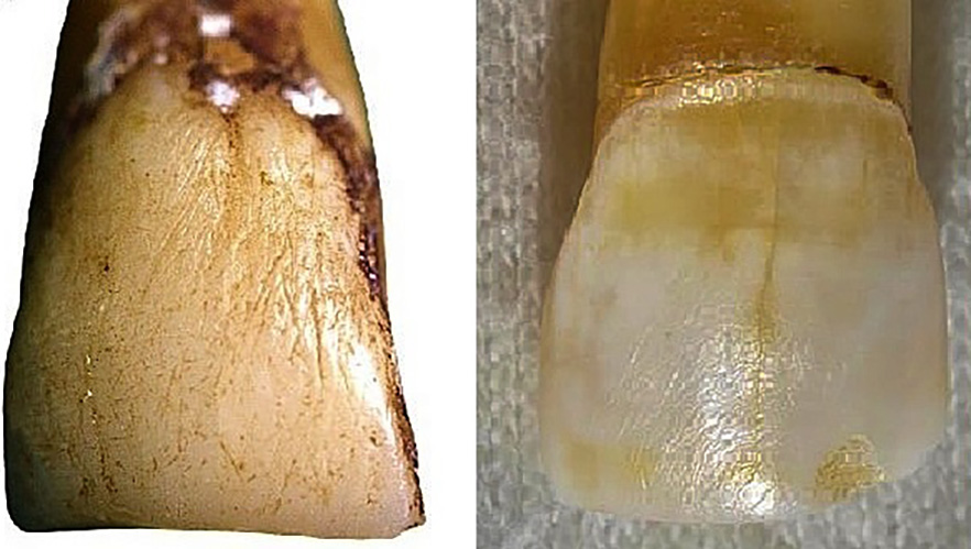 Macroscopic ridges on the outer surface of upper central macaque incisors image